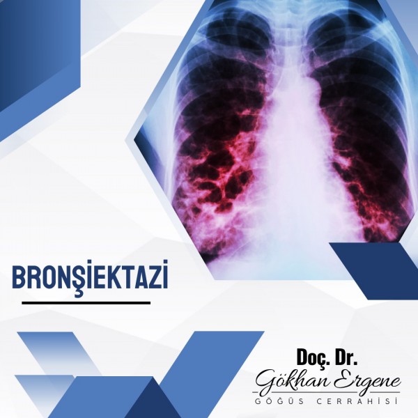 Bronşiektazi 1