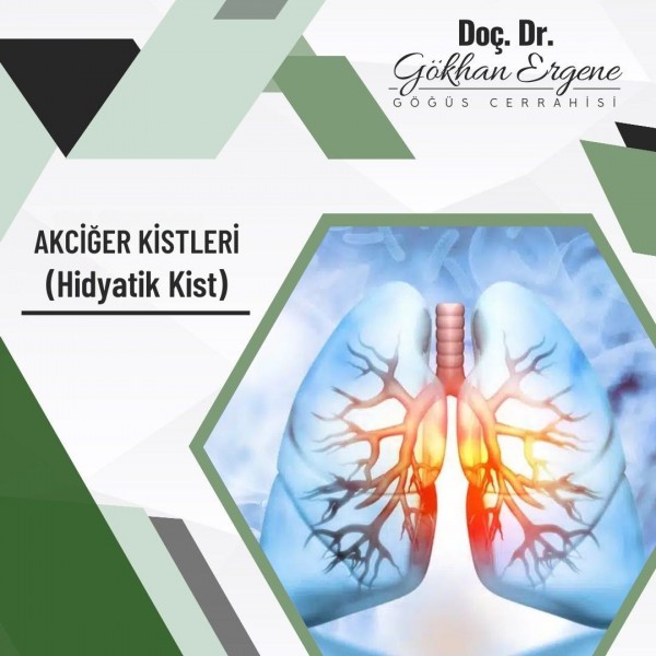 Akciğer Kistleri 1