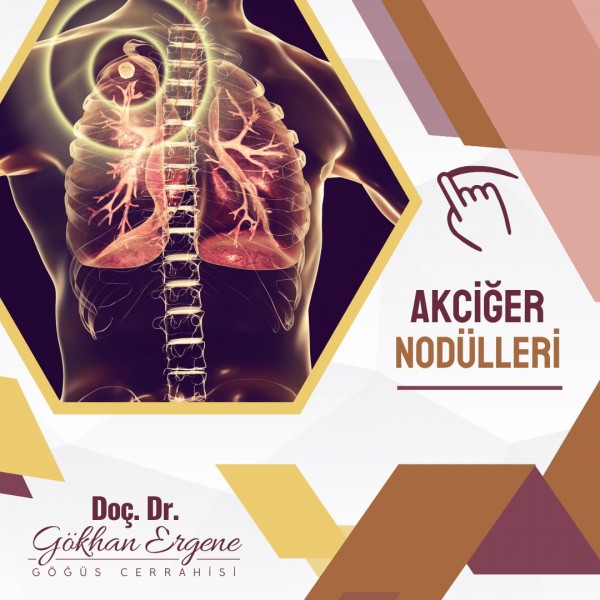 Akciğer Nodülleri