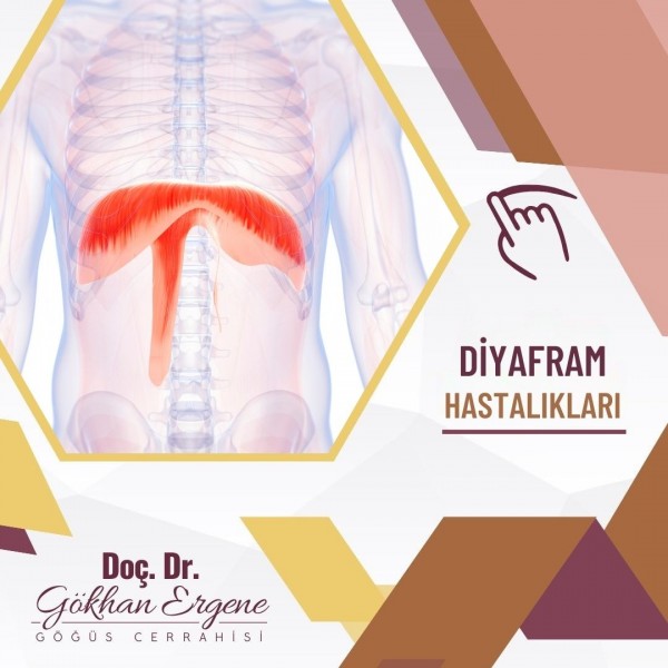 Diyafram Hastalıkları 1