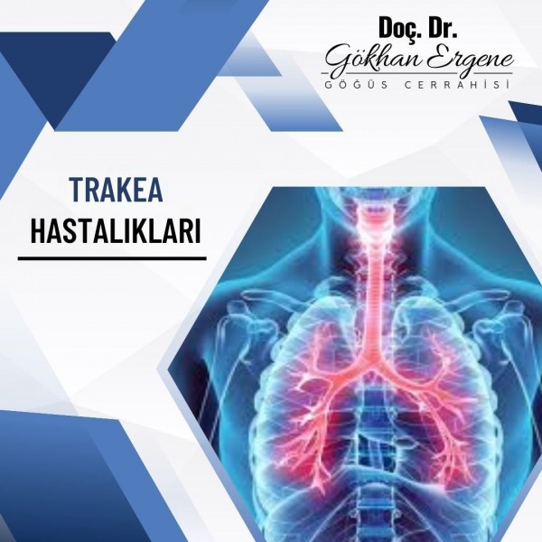 Trakea Hastalıkları 1